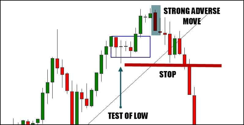 trading stop loss